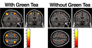 http://lifechangingcarehouston.com/green-tea-brain-connection